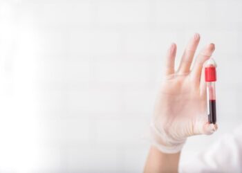 Positividade de casos de Febre Oropouche é maior que a de dengue no AM