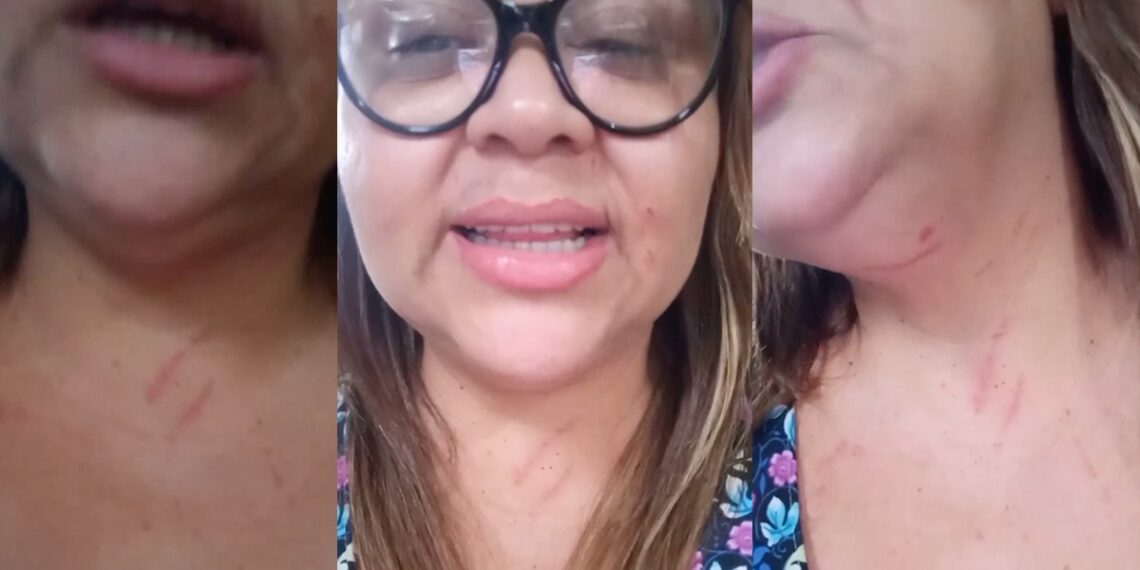 Levantadora de todas do Caprichoso é agredida por usar camisa do boi-bumbá